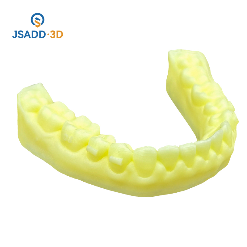 3d print tooth